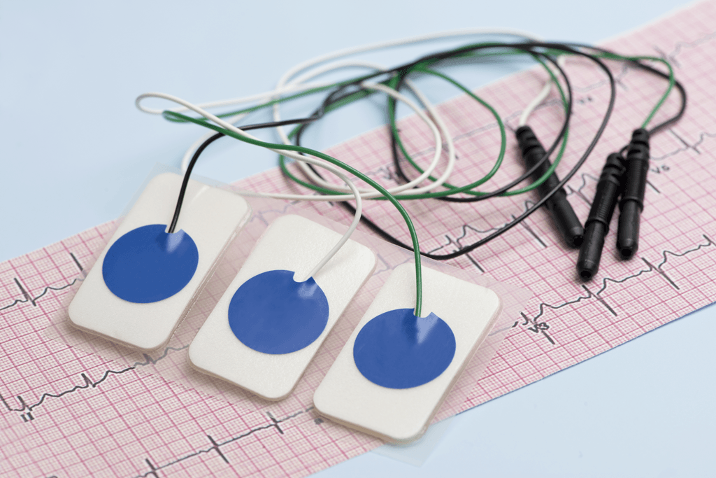 Electrogram_Citrus-Cardiology